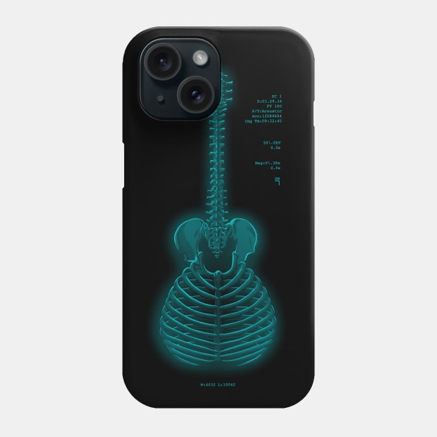 guitar anatomy Phone Case by victorcalahan