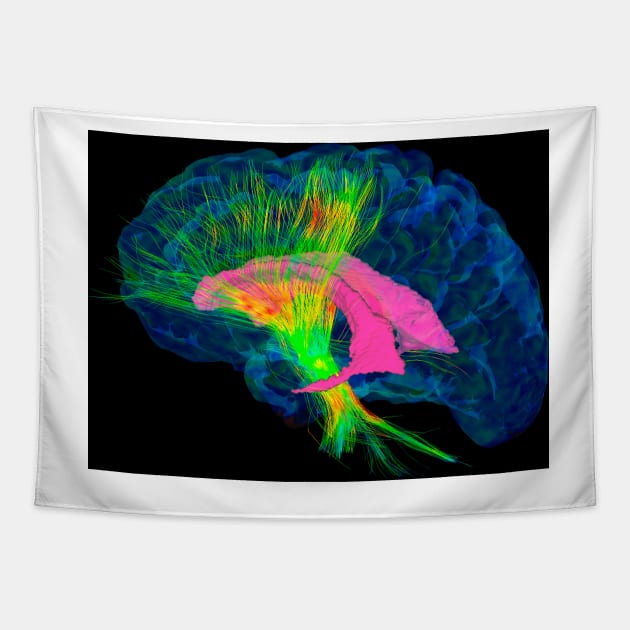 Brain fibres, DTI MRI scan (C017/7036) Tapestry by SciencePhoto