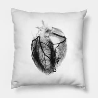 Coronary arteriogram of arteries of the heart 1904 (P216/0201) Pillow