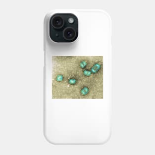 Influenzavirus B, TEM (M055/0432) Phone Case