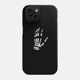 Robot Rock Phone Case