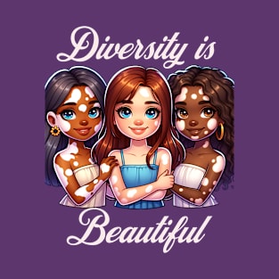 Vitiligo Awareness and Acceptance Diversity is Beautiful T-Shirt