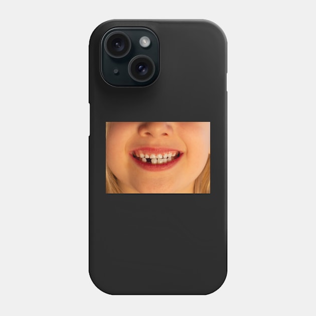 Smile! Super cute and really funny kid smile missing 1 tooth Phone Case by mivpiv