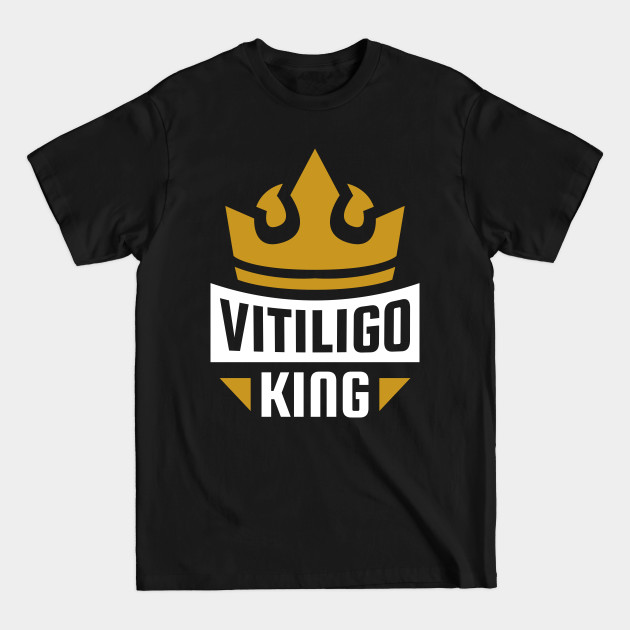 Vitiligo King - Vitiligo King - T-Shirt