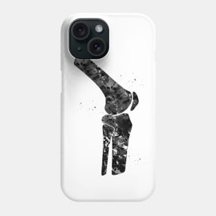 Knee Phone Case