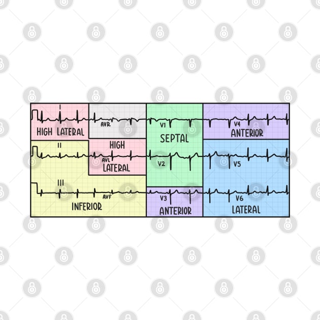 Hand Drawn Electrocardiogram (ECG) Pastel by Sofia Sava