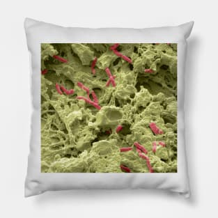 Pseudomonas lung infection, SEM (C021/7004) Pillow