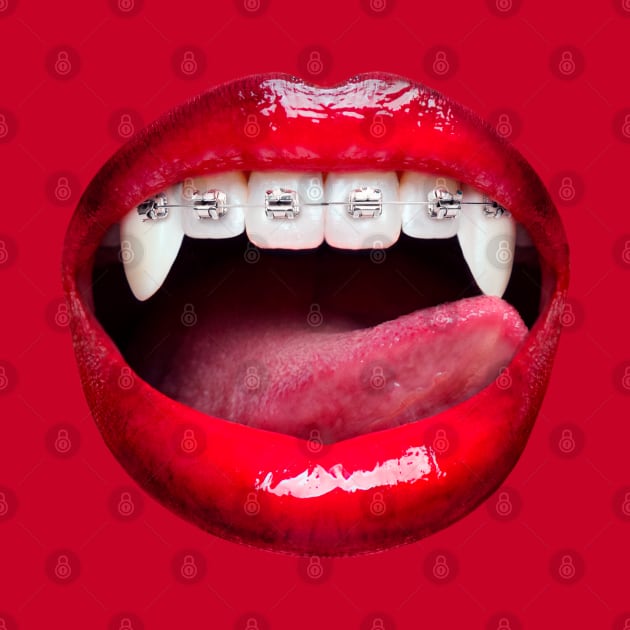 Vampire braces by brain360