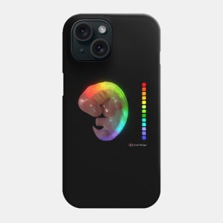 Hox Genes in Developing Embryo Phone Case