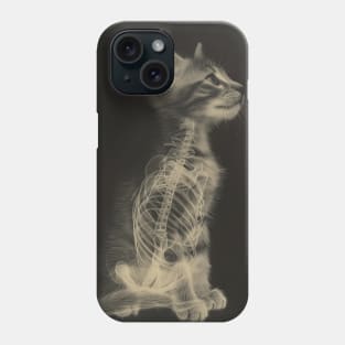 CAT Scan Phone Case