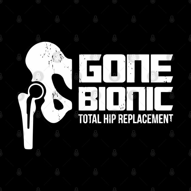 Gone Bionic, Total Hip Replacement by tanambos