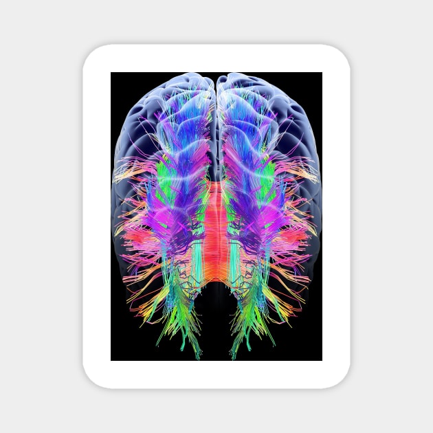 White matter fibres and brain, artwork (C015/1936) Magnet by SciencePhoto