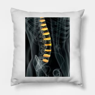 Human spinal intervertebral discs (F011/7098) Pillow