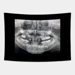 Dental x ray Tapestry