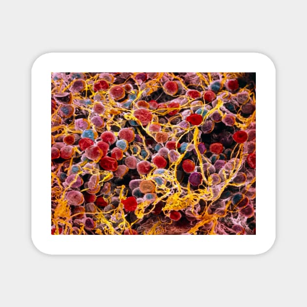 Coloured SEM of adipose tissue showing fat cells (P760/0014) Magnet by SciencePhoto