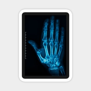 X-Ray Hand Magnet