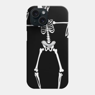 Skeleton Dancing Like an Egyption Phone Case