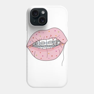 Braceface Phone Case