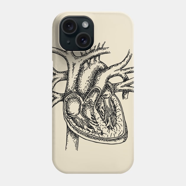 The Dissected Heart Sketch (Black) Phone Case by michaelkdamron