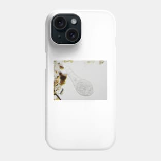 Bdelloid rotifer under the microscope Phone Case