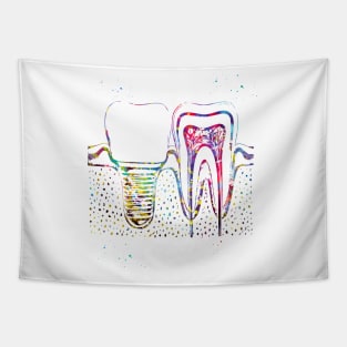 Human teeth and dental implant Tapestry