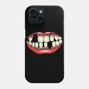 Lipstick Mouth With Missing Teeth Phone Case