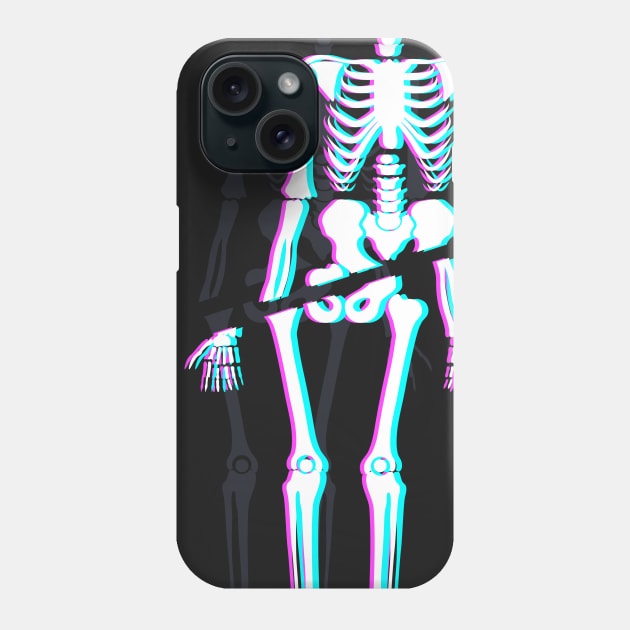 Spooky Skeleton - Vaporwave Aesthetic Phone Case by MeatMan