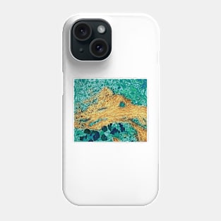 Alzheimer's disease brain cell, TEM (M108/0731) Phone Case