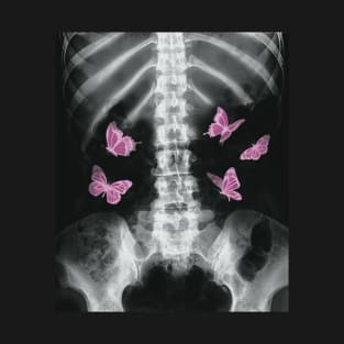 Egirl Xray Skeleton Pink Butterfly Harajuku y2k Dark Grunge T-Shirt