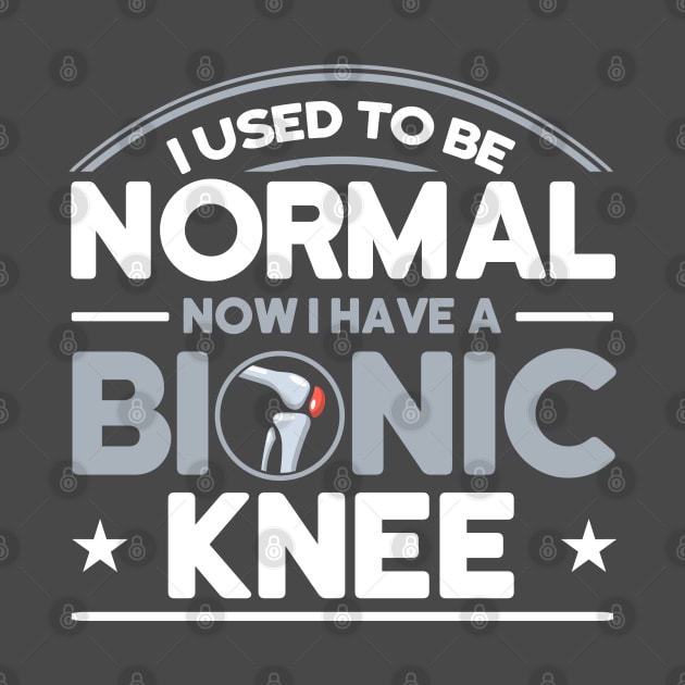 Patients I Used To Be Normal Bionic Knee Knee Replacement by Toeffishirts