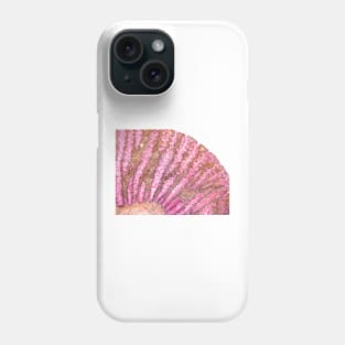 Colon, light micrograph (F006/9806) Phone Case