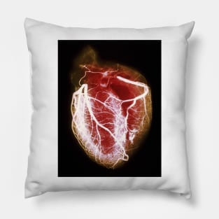 Coloured arteriogram of arteries of healthy heart (P216/0300) Pillow