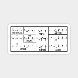 Hand Drawn 12 Lead Electrocardiogram (ECG) Black Magnet