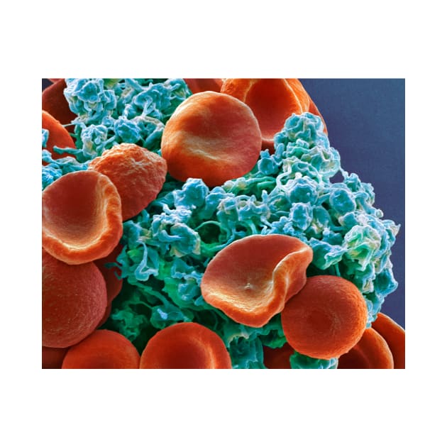 Red blood cells and platelets, SEM (C029/3211) by SciencePhoto