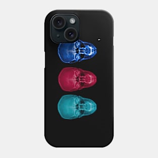 Three skulls , coloured X-ray skulls. Phone Case