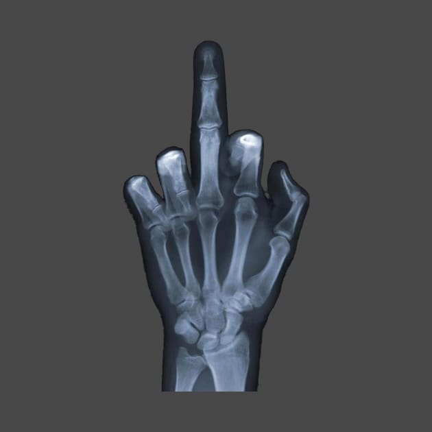 X-Ray Middle Finger by HelloImpossibility