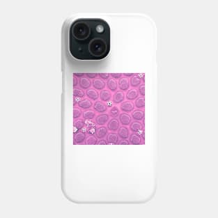 Diatom - Thalassiosira in SEM (cribra, pink) Phone Case