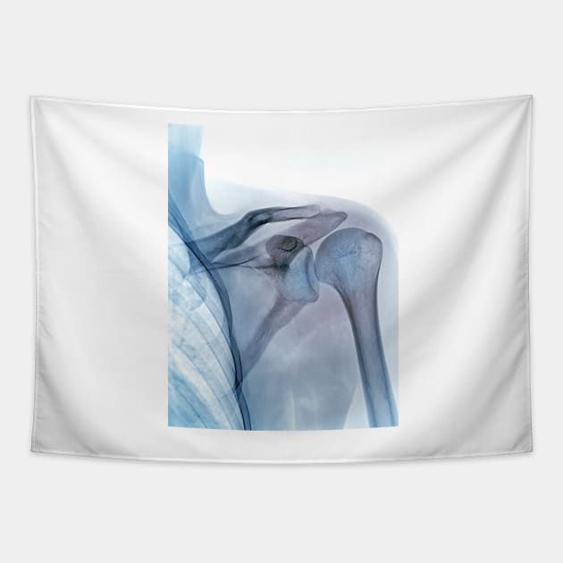 Shoulder joint, X-ray (C040/3239) Tapestry by SciencePhoto