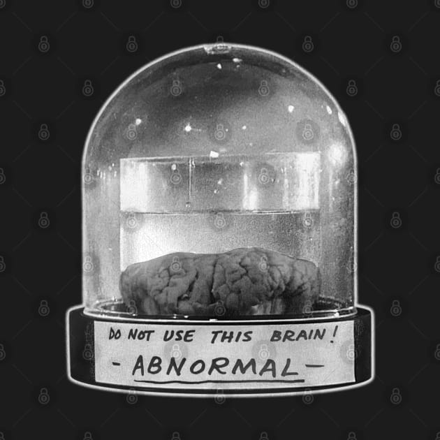 ABNORMAL Brain Jar by darklordpug