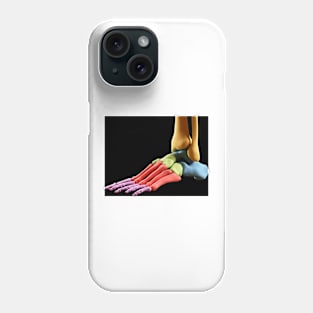 Human foot anatomy, illustration (F011/5689) Phone Case