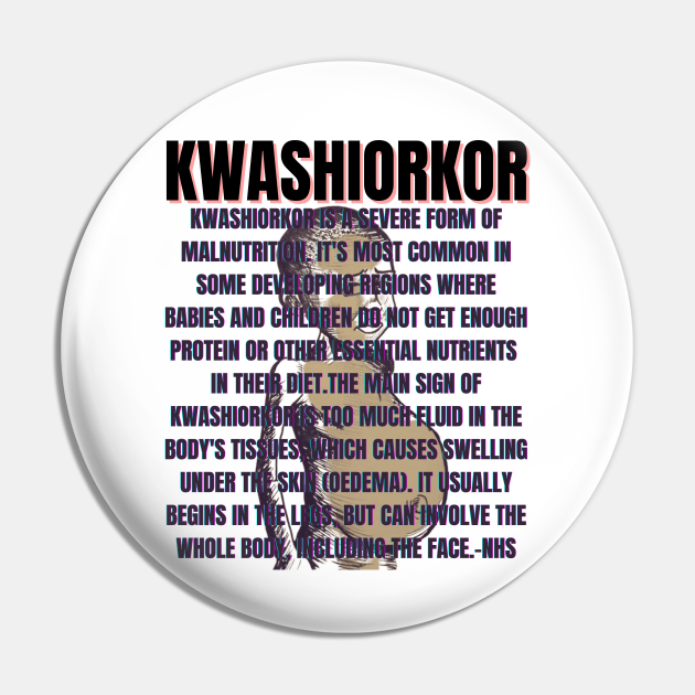 KWASHIORKOR Malnutrition Pin TeePublic