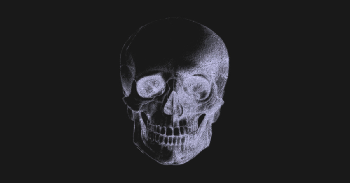 Skull X Ray By Artvixen