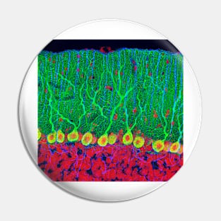 Purkinje nerve cells in the cerebellum (P360/0474) Pin