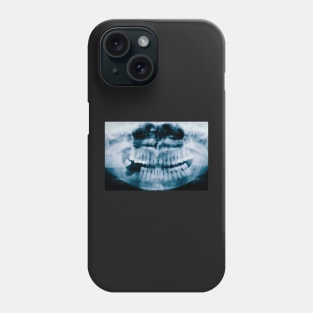 X-Ray Teeth Phone Case