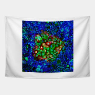 Colorectal cancer cells, light micrograph (C021/6371) Tapestry