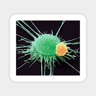 T lymphocyte and cancer cell, SEM (C022/6435) Magnet