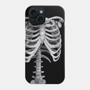 Ribs Sketch - Anatomy Drawing - Skeleton Phone Case