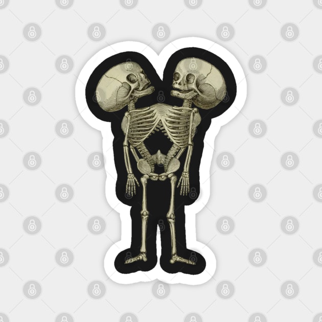 Siamese Twins Skeleton Magnet by blackjackdavey