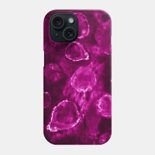 Burgundy Tie-Dye Orbs Phone Case