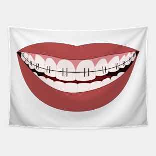 Big smile teeth braces mask design Tapestry